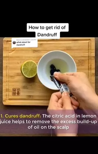 Sampo dicampur 1 jenis buah bisa atasi ketombe membandel Berbagai sumber