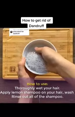 Sampo dicampur 1 jenis buah bisa atasi ketombe membandel Berbagai sumber