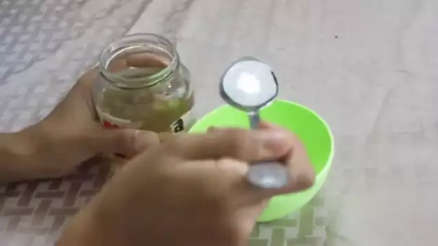 Cara memutihkan dan menghilangkan karang gigi © YouTube