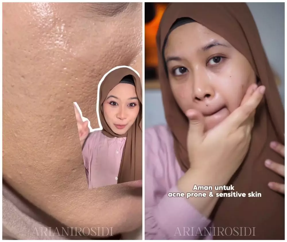 Trik menutup pori-pori saat pakai makeup © YouTube