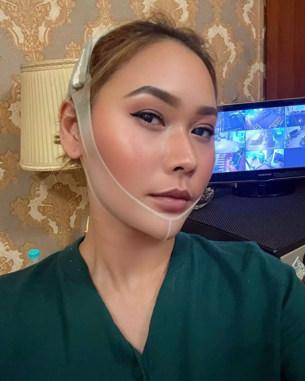 perawatan Inul Daratista © Instagram