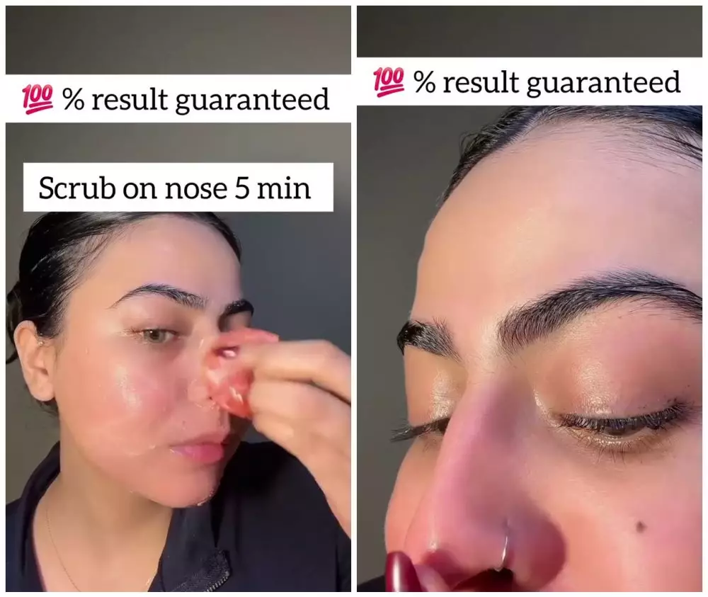 Cara ampuh hempaskan komedo hitam © Instagram