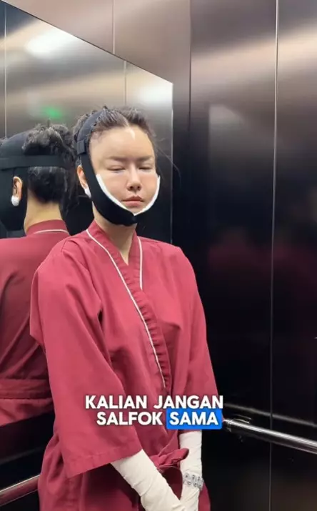 Nita Gunawan jalani transfer dan sedot lemak di Korea © Instagram Nita Gunawan jalani transfer dan sedot lemak di Korea © Instagram