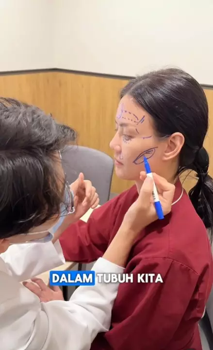 Nita Gunawan jalani transfer dan sedot lemak di Korea © Instagram Nita Gunawan jalani transfer dan sedot lemak di Korea © Instagram