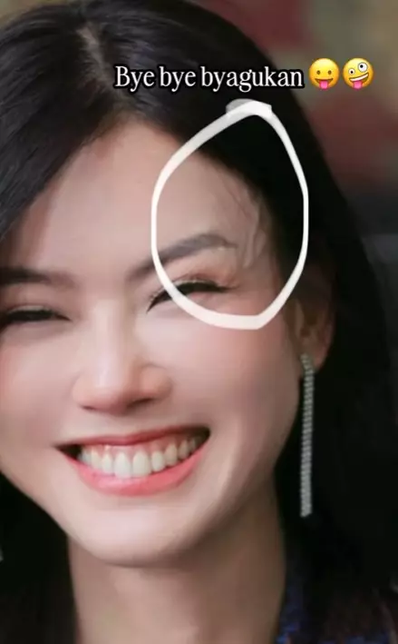 Nita Gunawan jalani transfer dan sedot lemak di Korea © Instagram Nita Gunawan jalani transfer dan sedot lemak di Korea © Instagram