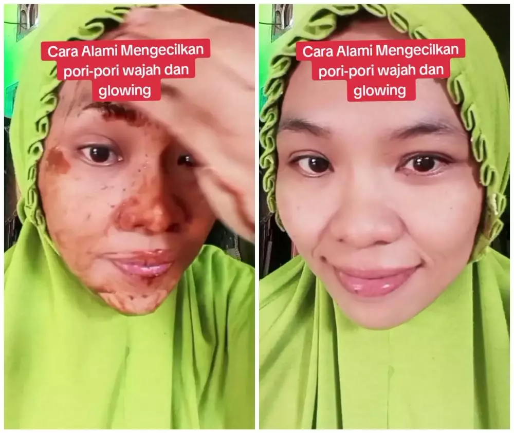 cara alami mengecilkan pori-pori pakai madu © YouTube