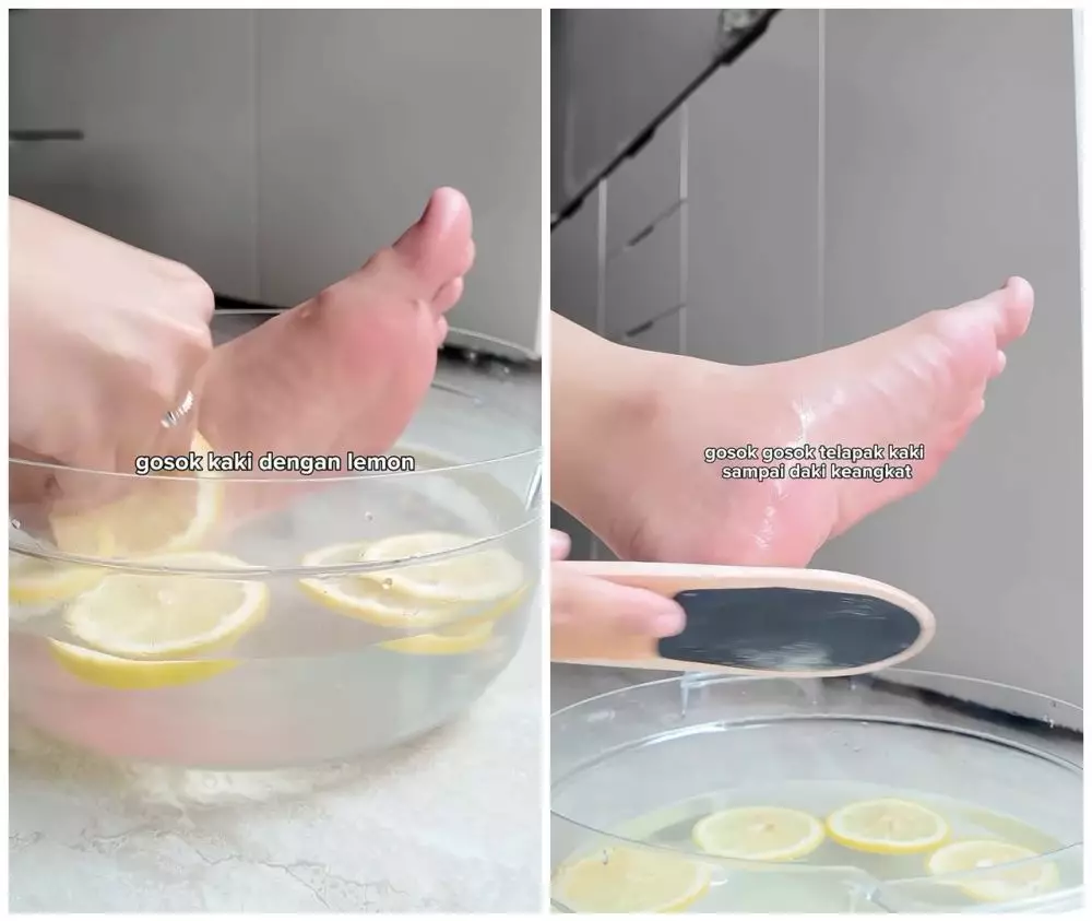 Cara mudah mengatasi kaki kering © Instagram Cara mudah mengatasi kaki kering © Instagram