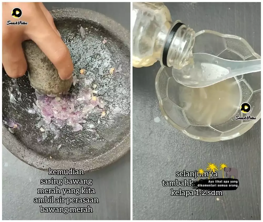 Cara ampuh menumbuhkan rambut © YouTube Cara ampuh menumbuhkan rambut © YouTube