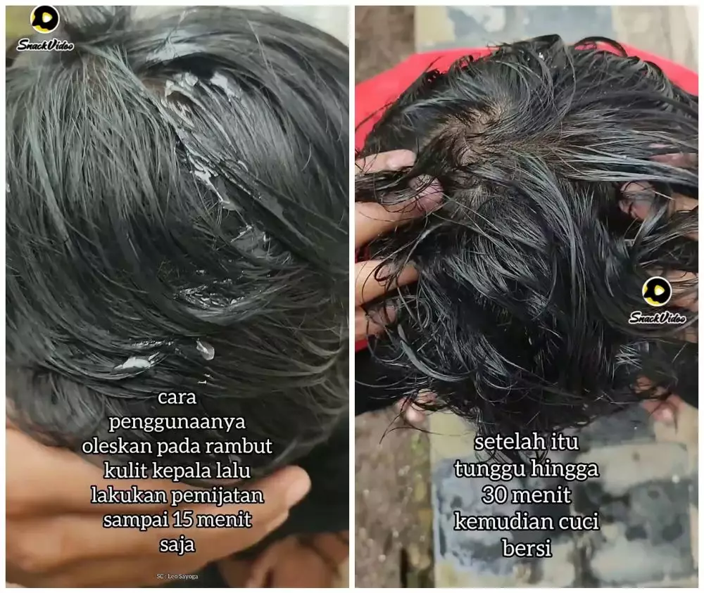 Cara ampuh menumbuhkan rambut © YouTube Cara ampuh menumbuhkan rambut © YouTube