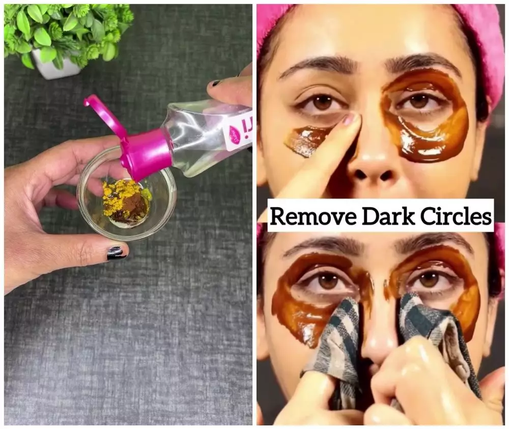 cara atasi mata panda secara alami © Instagram