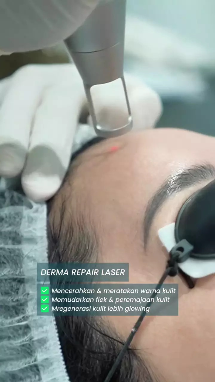 perawatan wajah Lulu Tobing © Instagram