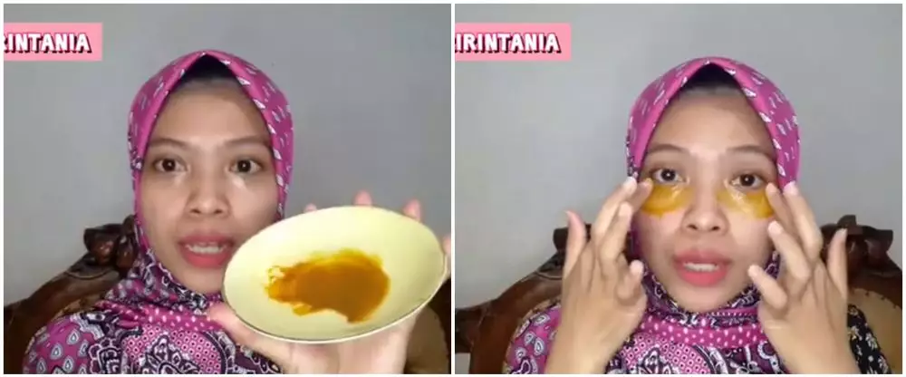 cara menghilangkan kerutan halus di bawah mata © YouTube