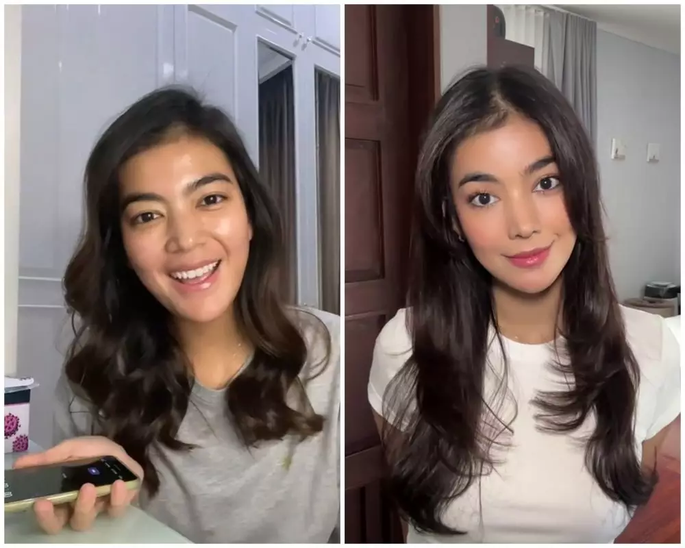 before-after Raya Kohandi usai jalani operasi © Instagram