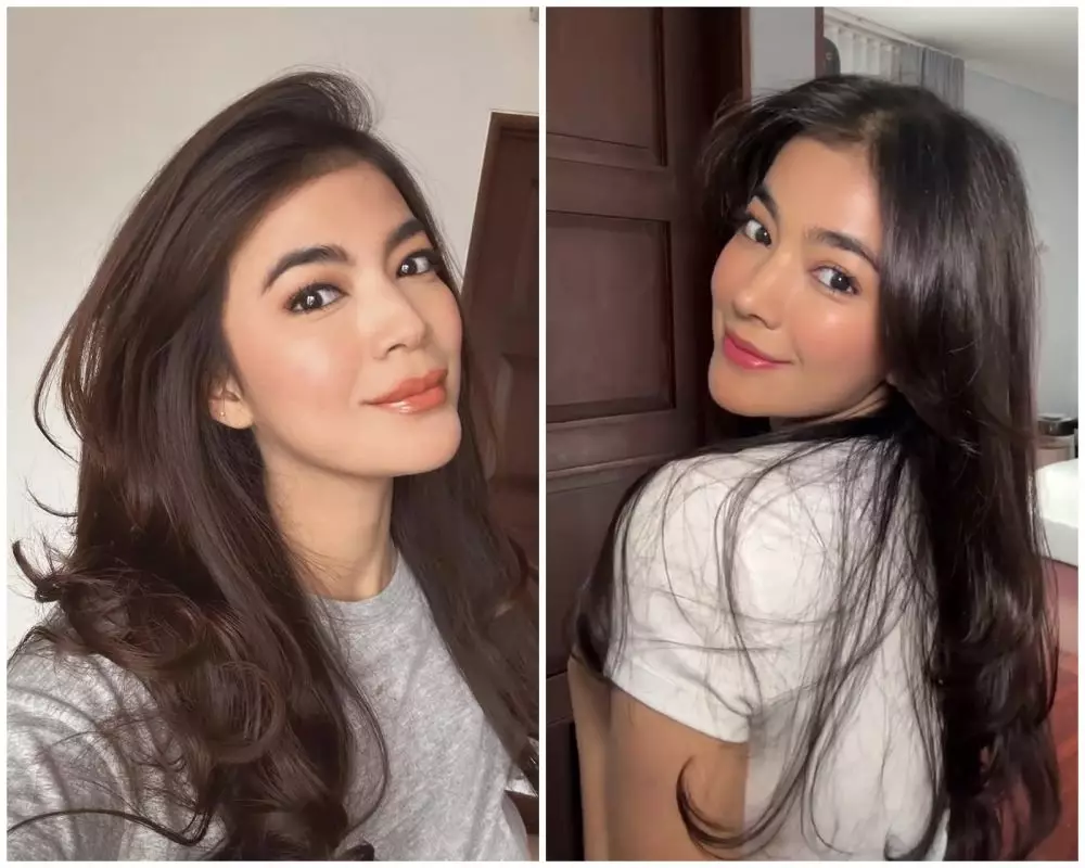 before-after Raya Kohandi usai jalani operasi © Instagram