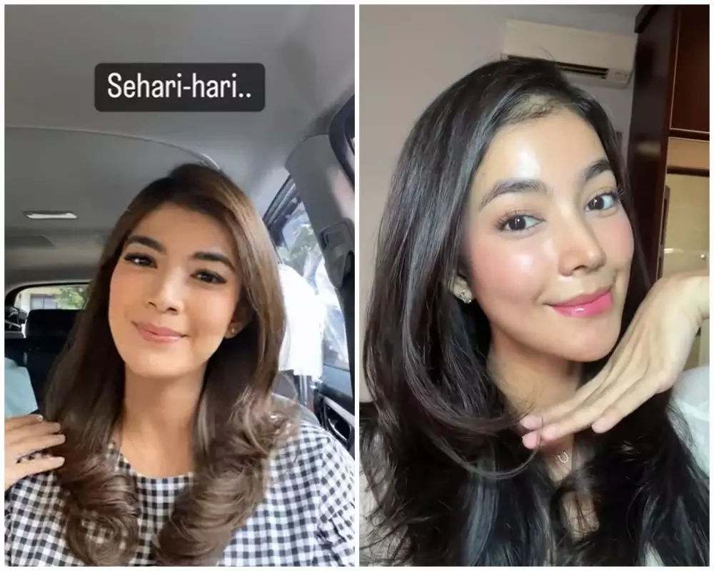 before-after Raya Kohandi usai jalani operasi © Instagram