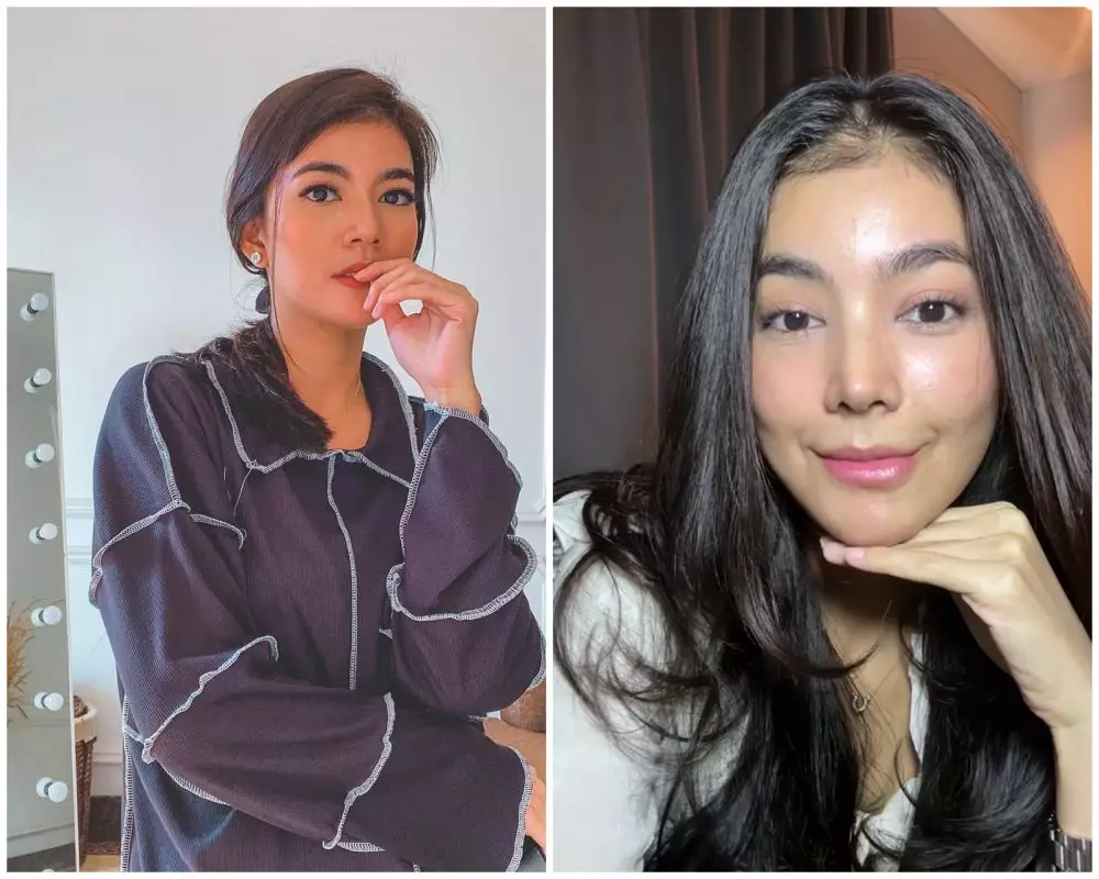 before-after Raya Kohandi usai jalani operasi © Instagram