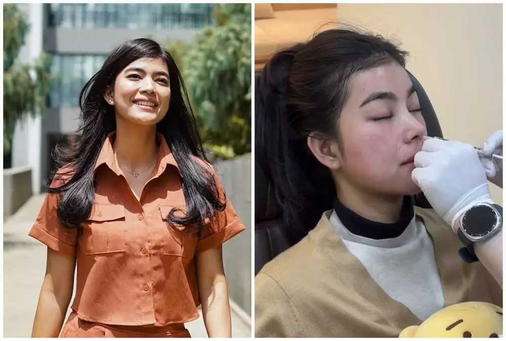 before-after Raya Kohandi usai jalani operasi © Instagram