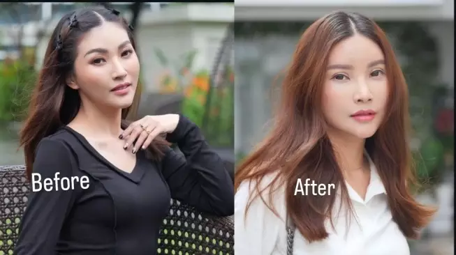 rewrite 25 seleb operasi plastik © 2025 brilio.net