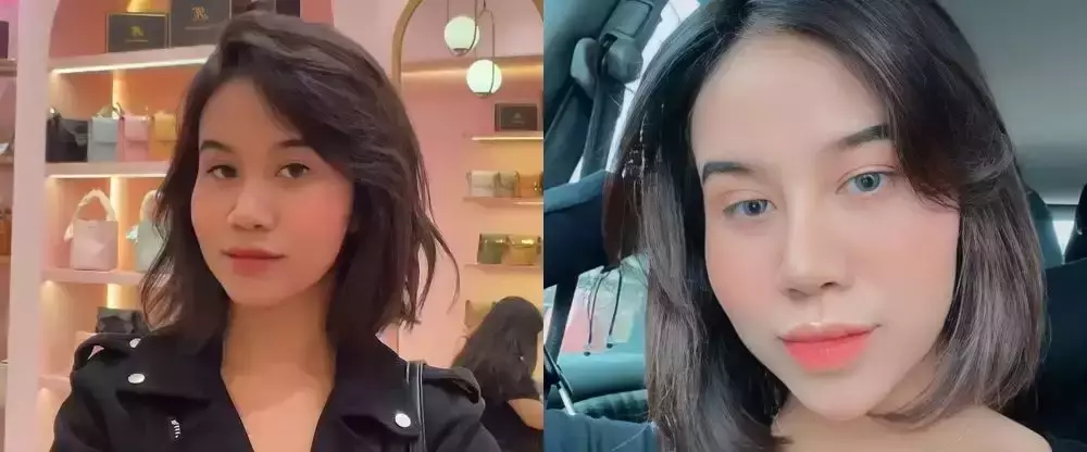 rewrite 25 seleb operasi plastik © 2025 brilio.net