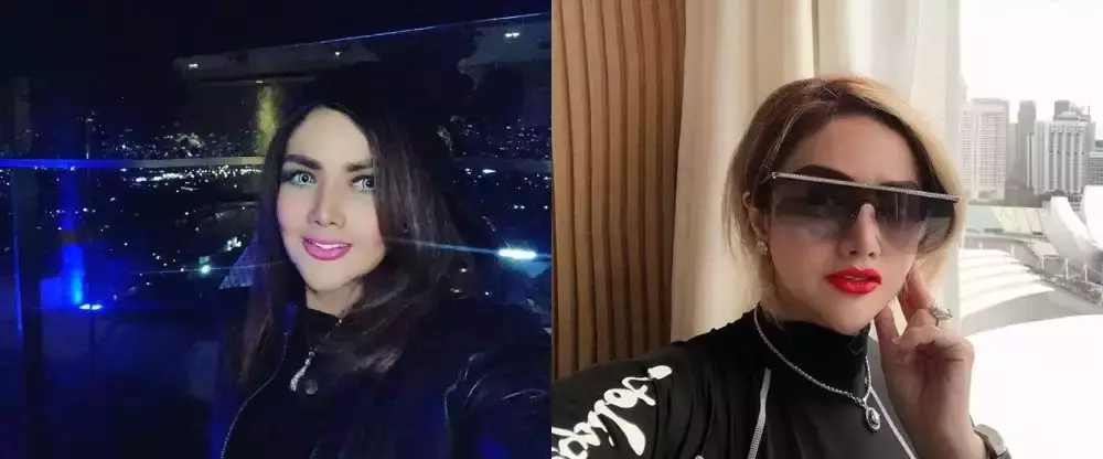 rewrite 25 seleb operasi plastik © 2025 brilio.net