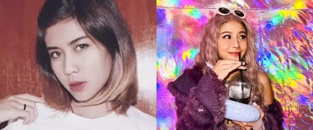 rewrite 25 seleb operasi plastik © 2025 brilio.net