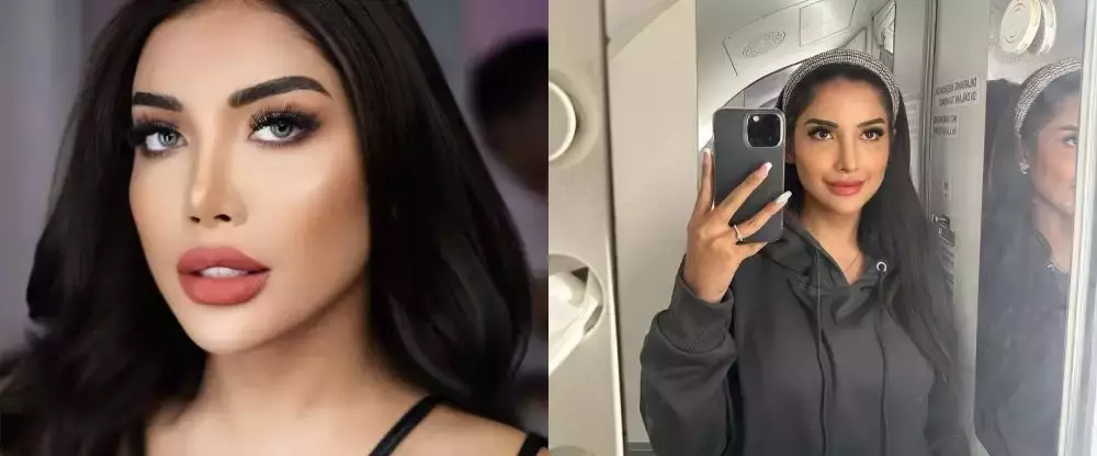 rewrite 25 seleb operasi plastik © 2025 brilio.net