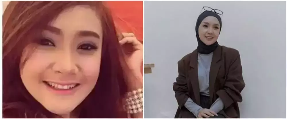 10 potret penyanyi veneer gigi © 2025 brilio.net