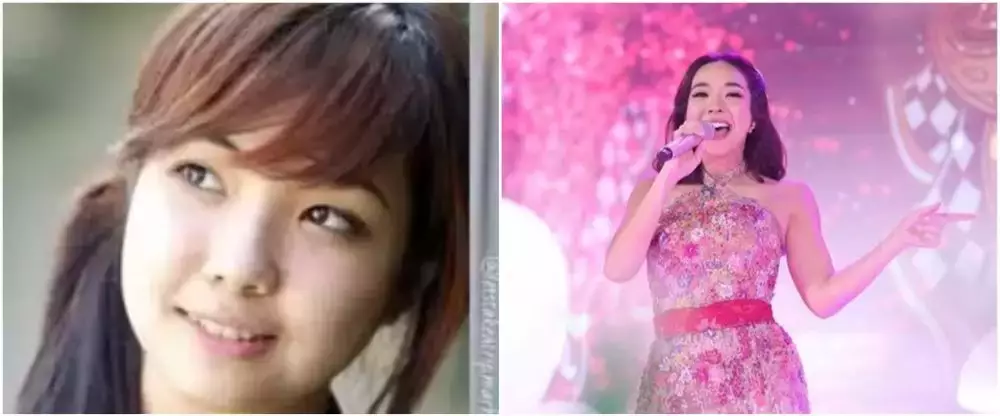 10 potret penyanyi veneer gigi © 2025 brilio.net