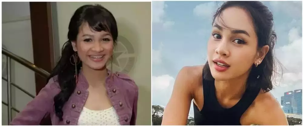 10 potret penyanyi veneer gigi © 2025 brilio.net