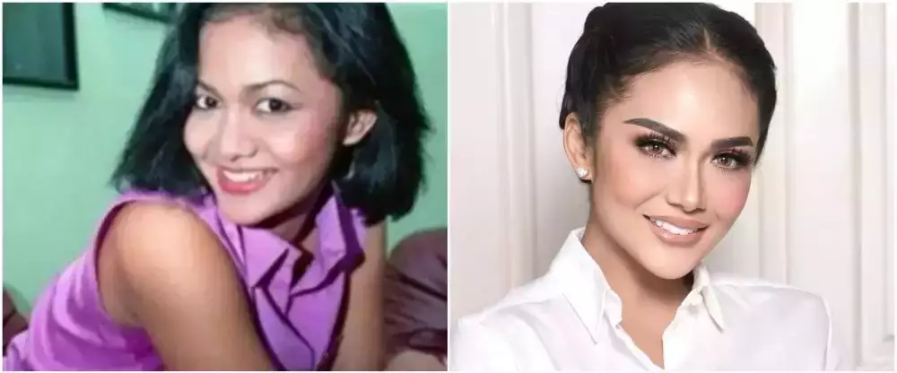 10 potret penyanyi veneer gigi © 2025 brilio.net