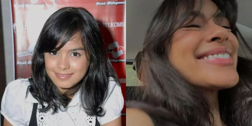 10 potret penyanyi veneer gigi © 2025 brilio.net