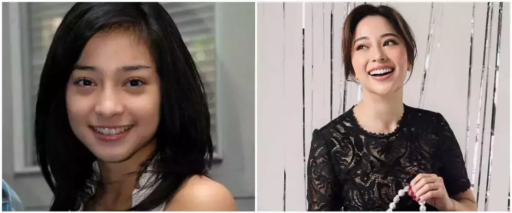 10 potret penyanyi veneer gigi © 2025 brilio.net