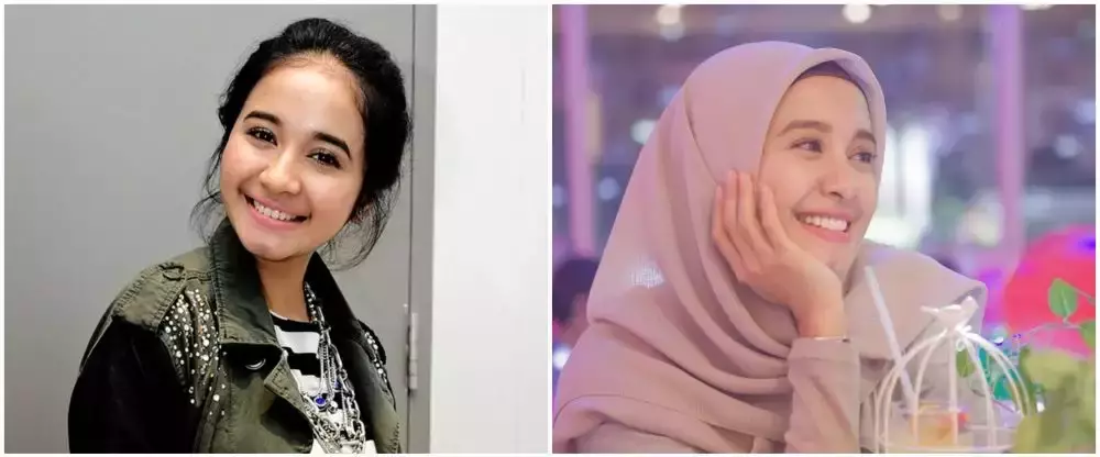 10 potret penyanyi veneer gigi © 2025 brilio.net