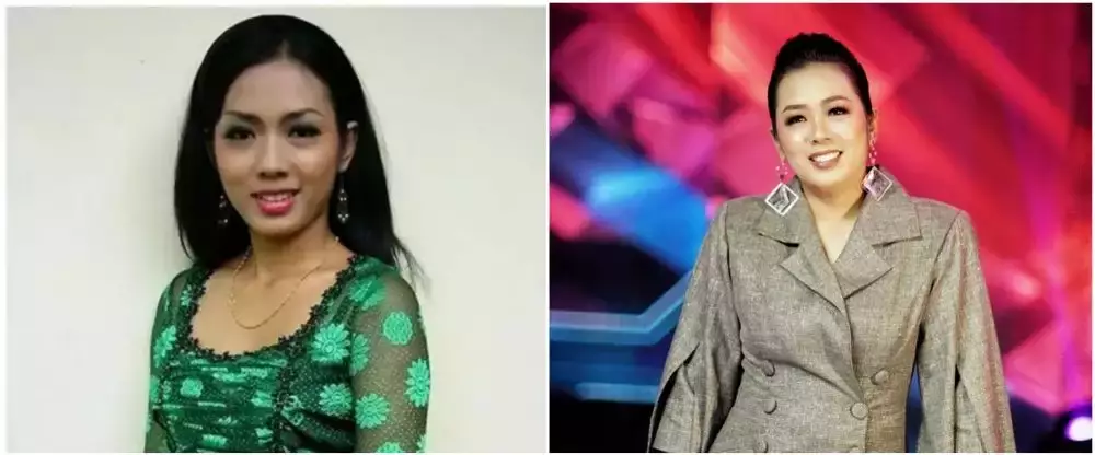 10 potret penyanyi veneer gigi © 2025 brilio.net