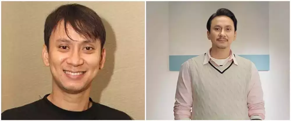 13 seleb transplantasi rambut © 2025 brilio.net 13 seleb transplantasi rambut © 2025 brilio.net