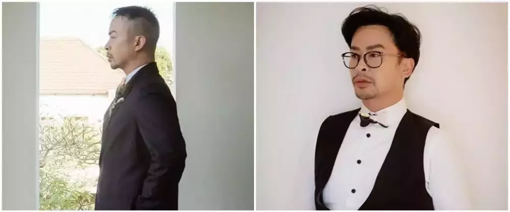 13 seleb transplantasi rambut © 2025 brilio.net 13 seleb transplantasi rambut © 2025 brilio.net