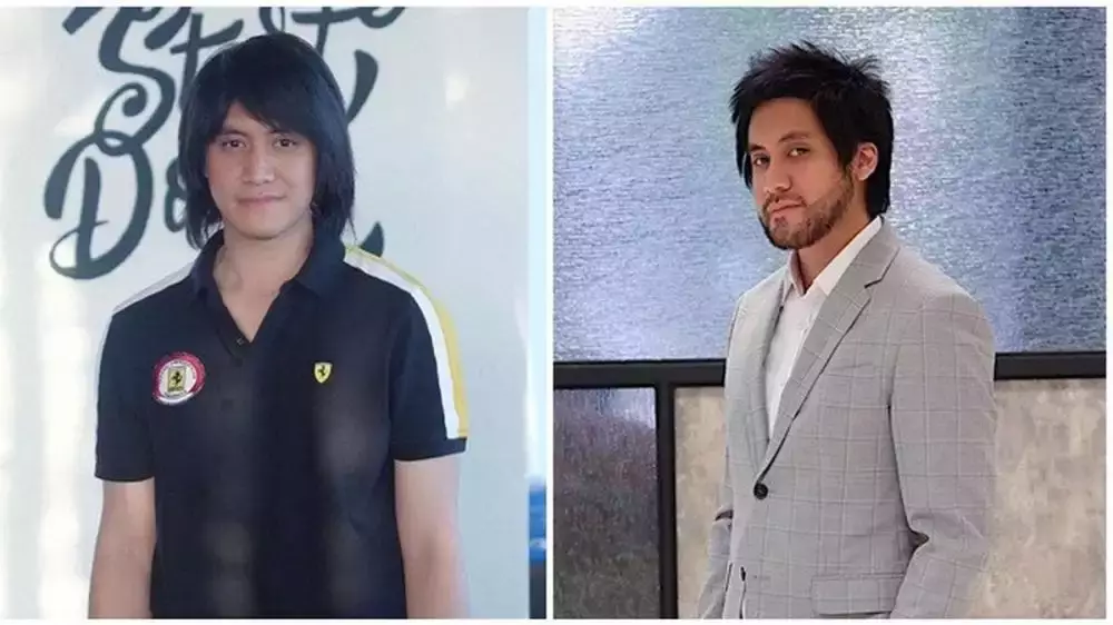 13 seleb transplantasi rambut © 2025 brilio.net 13 seleb transplantasi rambut © 2025 brilio.net