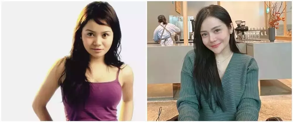 potret Mawar AFI jalani buccal fat © 2025 brilio.net