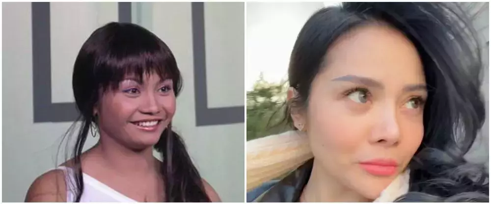 potret Mawar AFI jalani buccal fat © 2025 brilio.net