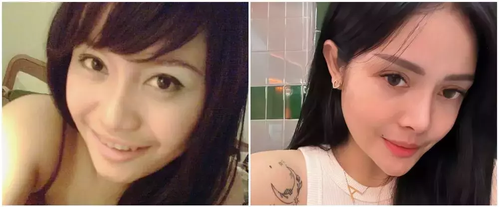 potret Mawar AFI jalani buccal fat © 2025 brilio.net