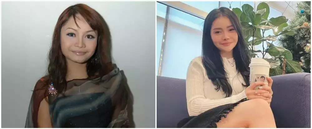 potret Mawar AFI jalani buccal fat © 2025 brilio.net