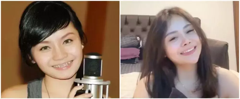 potret Mawar AFI jalani buccal fat © 2025 brilio.net