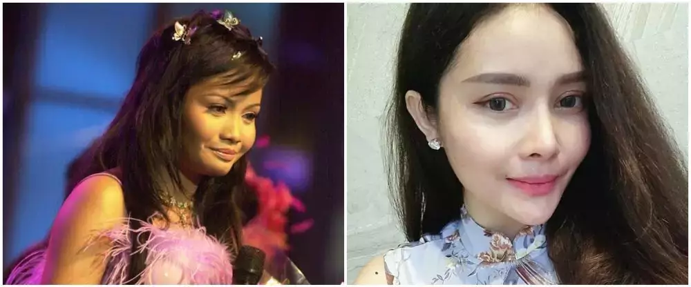 potret Mawar AFI jalani buccal fat © 2025 brilio.net