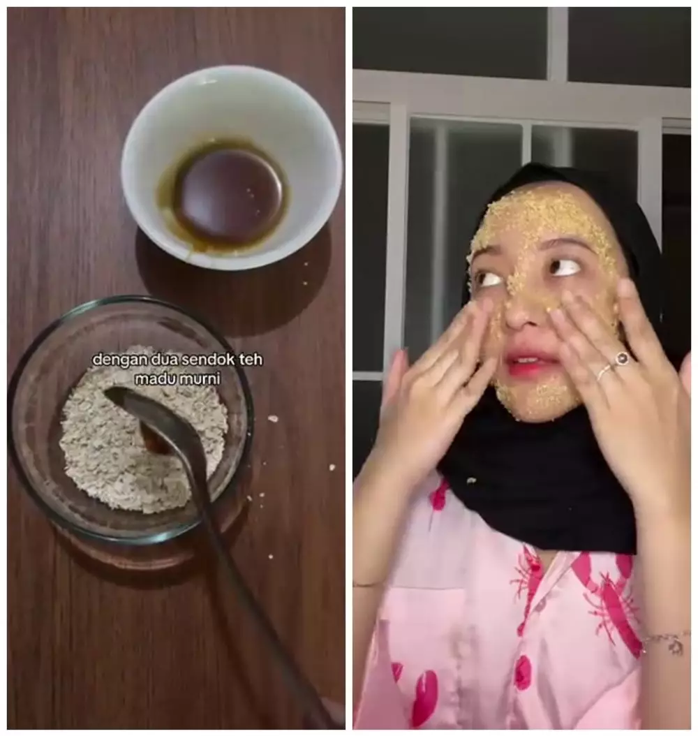Cara hilangkan bekas jerawat dan komedo © Instagram Cara hilangkan bekas jerawat dan komedo © Instagram