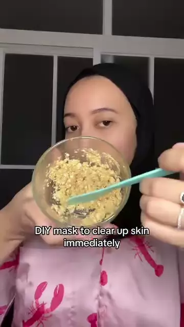 Cara hilangkan bekas jerawat dan komedo © Instagram Cara hilangkan bekas jerawat dan komedo © Instagram