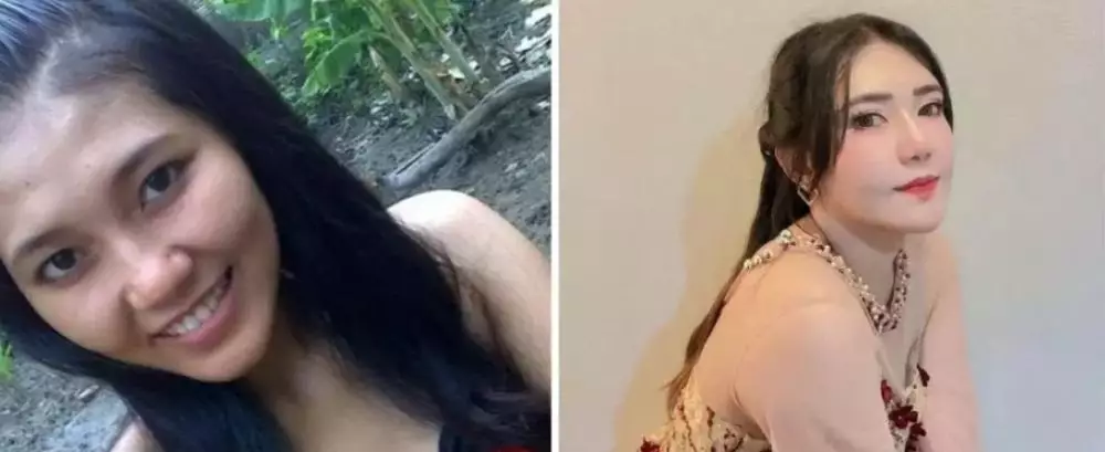 15 potret wajah seleb oplas dagu © 2025 brilio.net