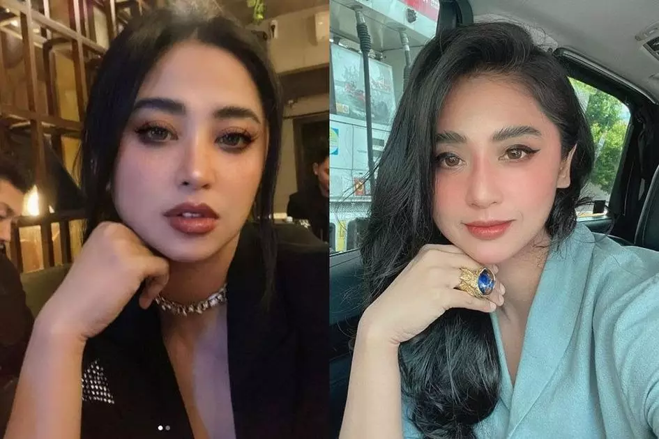 15 potret wajah seleb oplas dagu © 2025 brilio.net