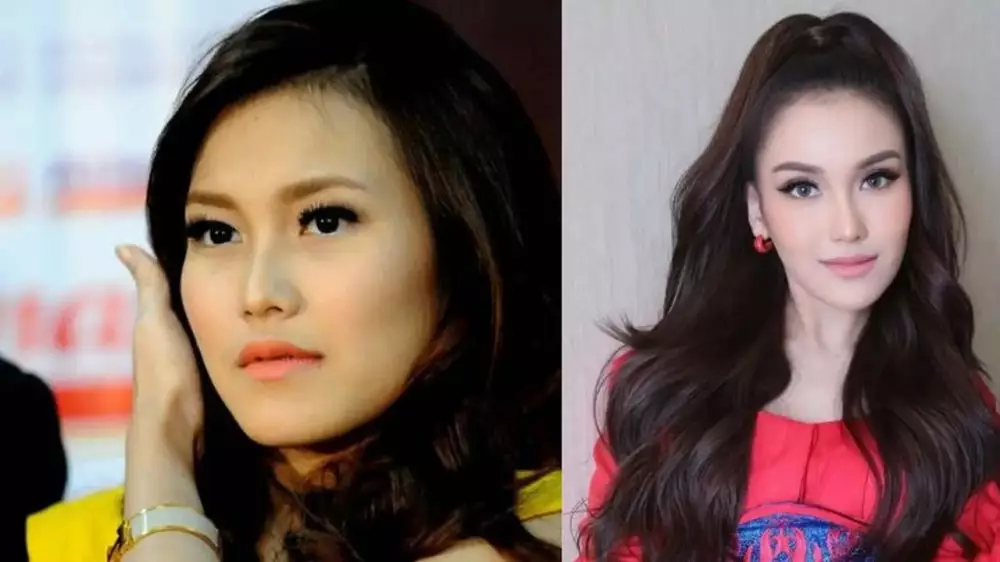 15 potret wajah seleb oplas dagu © 2025 brilio.net