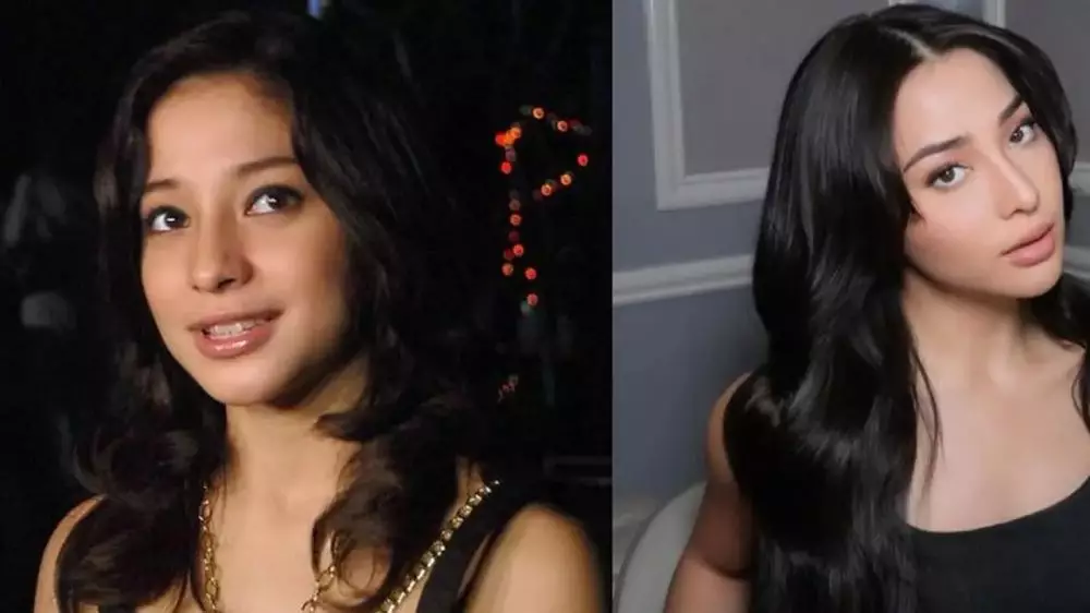 15 potret wajah seleb oplas dagu © 2025 brilio.net