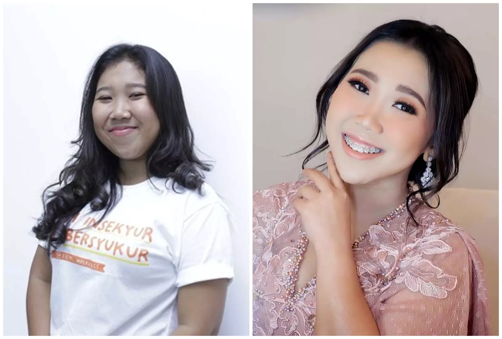 Potret wajah 15 seleb sebelum dan sesudah permak dagu, perubahannya drastis jadi tampak tirus